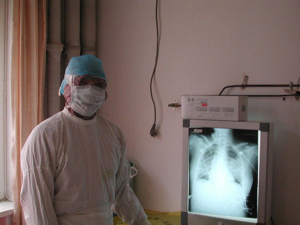 Cảnh báo của bác sĩ Trung Quốc phục hồi sau nhiễm virus corona - 1